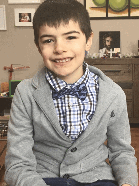 Dx Autism Spectrum Disorder