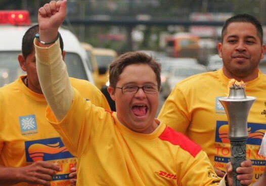 Down syndrome Trisomy 21 Case study success -Ariel